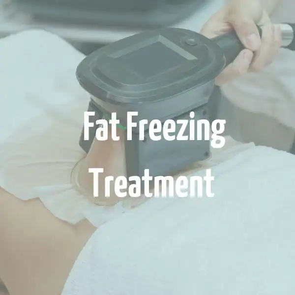 fat freezing treatment Bristol