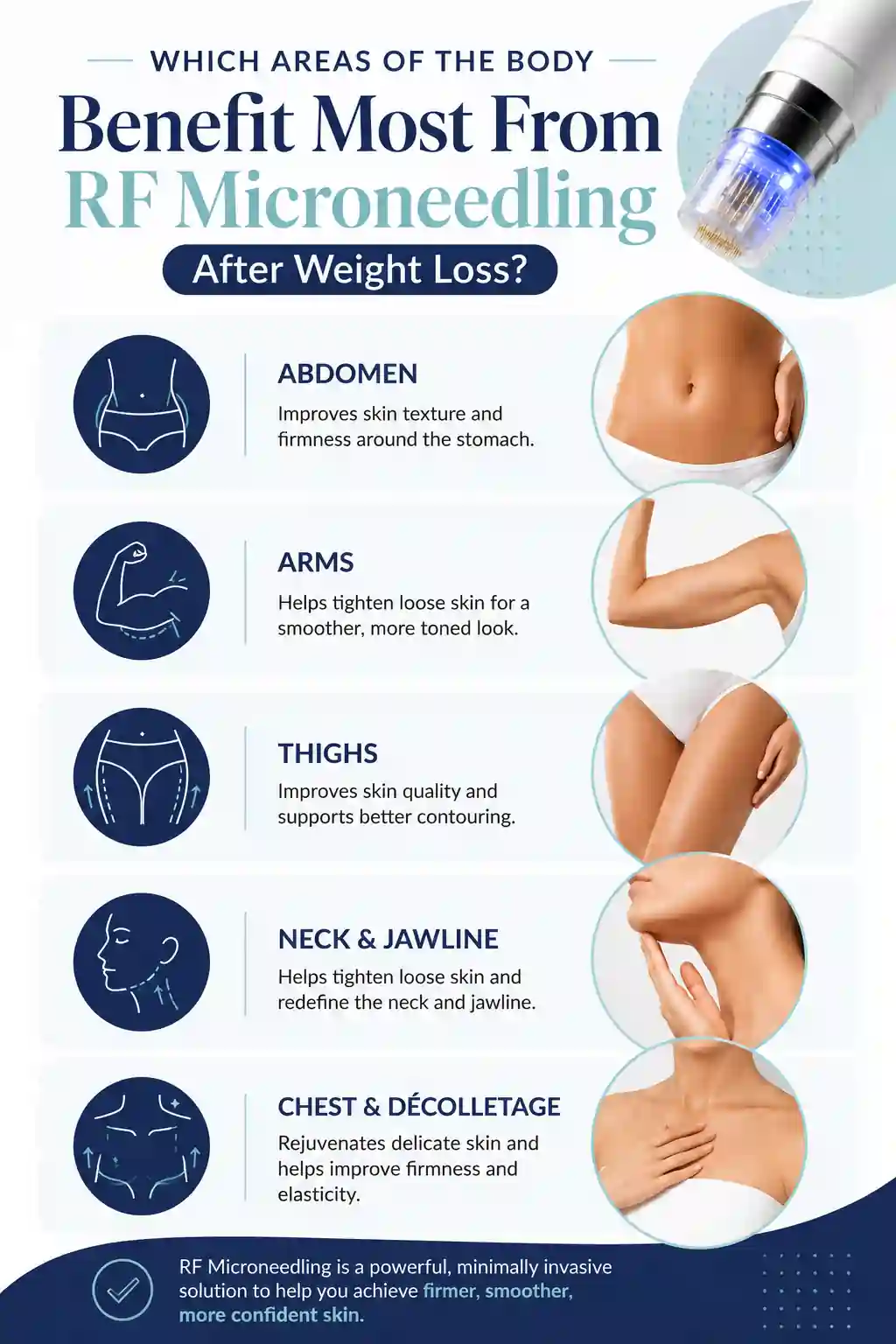Which Areas of the Body Benefit Most From RF Microneedling After Weight Loss Bristol